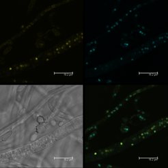Fig. 1: Hyphal fusion. Top left: Histon::YFP transformant with yellow nuclei; top right: Histon::CFP transformant with blue nuclei; bottom left: bright field; bottom right: overlay of top figures indicating hyphal fusion (green nuclei).