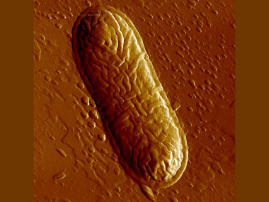 Evolutionary trade-offs: Balancing genetic disease risks and pathogen protection