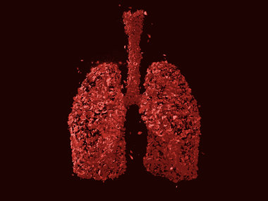 Bacterial colonisation of the lung also depends on the host genome