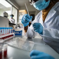 PCR Test im Labor.