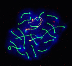 Die Abbildung zeigt eine Mauszelle (eine Spermatozyte), in der fehlerhaftes Vermischen von Erbmaterial vorliegt. Das Bild wurde mit einem Konfokal-Mikroskop aufgenommen. In der Zelle wurden relevante Proteine mithilfe der Immunfluoreszenzmarkierung angefärbt, um die Prozesse der Rekombination im Detail zu studieren.