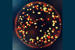 P. aeruginosa bacteria that were labelled with a yellow or red fluorescent marker and are here growing on an agar plate.