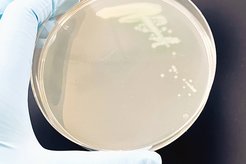 Colonies of Pseudomonas aeruginosa bacteria streaked on an agar plate.