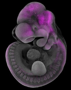 expression of Mn1 (magenta) in a mouse embryo